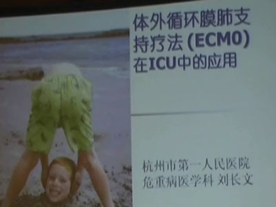 体外循环膜肺支持疗法（ECMO）在ICU中的应用          